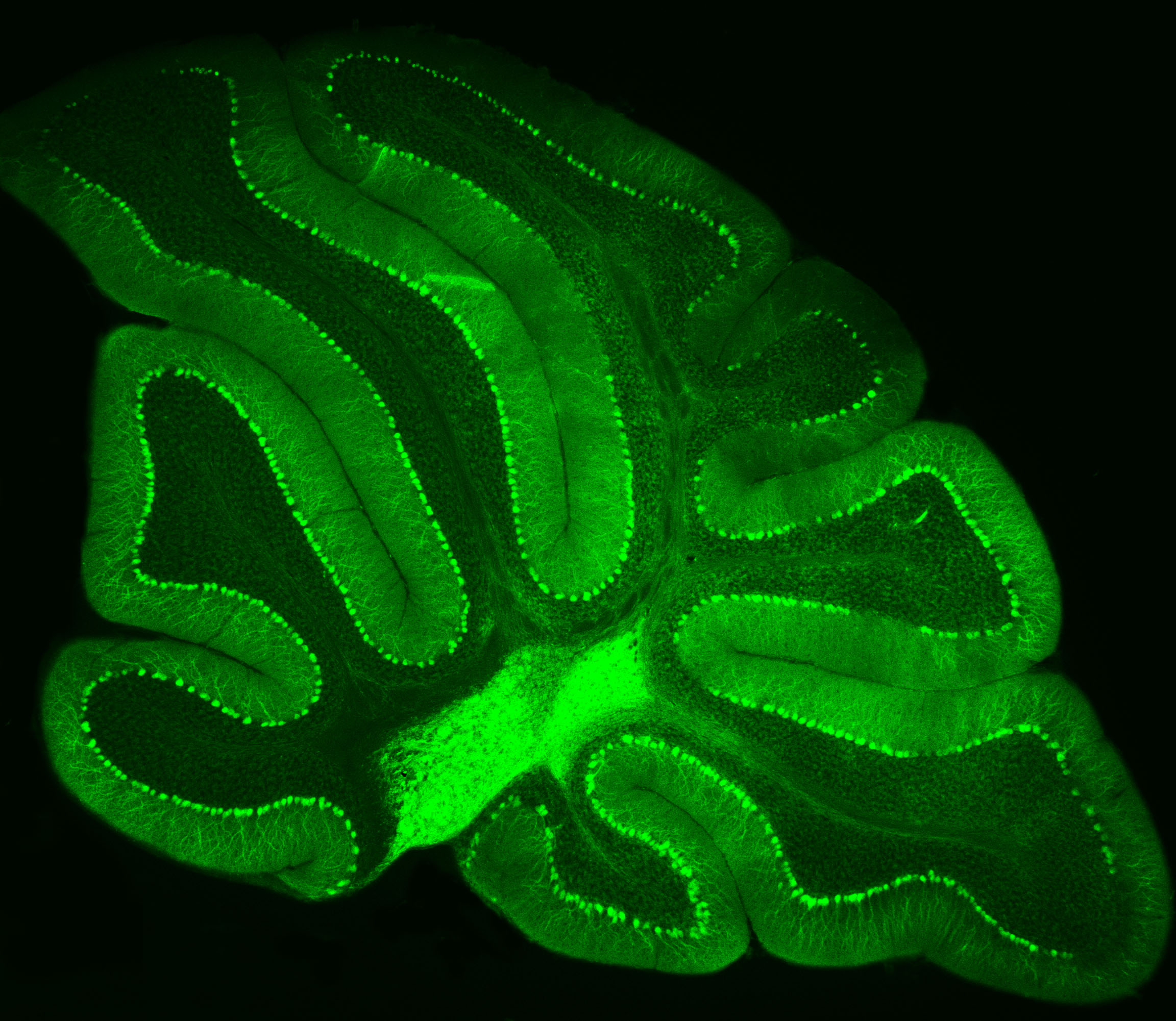 Purkinje neurons from an animal model are labeled with green fluorescent protein (GFP), which causes them to glow bright green. Credit: Pennington Biomedical